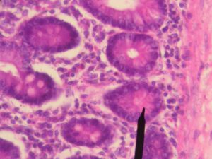 キレイすぎる世界に潜むリスク：生物多様性と免疫の意外な関係